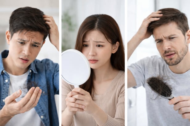 生髮水推薦懶人包｜3款人氣生髮水一次看懂