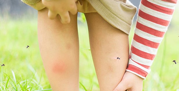 不知道選哪款？止癢貼片這樣挑最簡單！